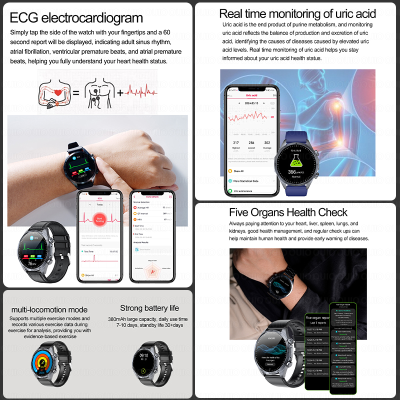 Jam Tangan Pintar Pemeriksa Ke - Smartwatch Watches Brands For Women ulasan dan harga